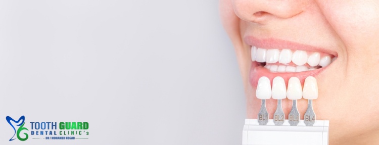 سعر هوليود سمايل 2025